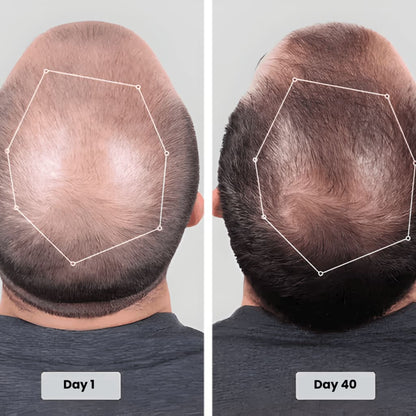 Infrared Growth Cap for Hair Regrowth Treatment