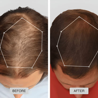 Infrared Growth Cap for Hair Regrowth Treatment