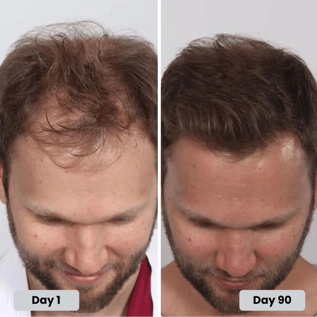 Infrared Growth Cap for Hair Regrowth Treatment